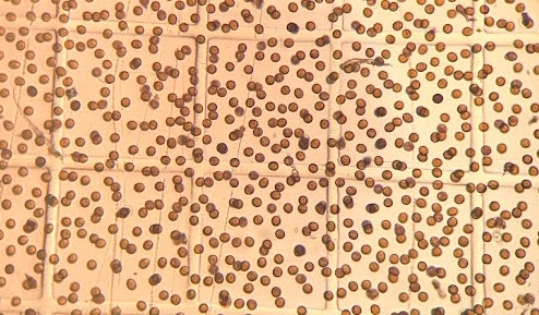Juvenile hard clams in their larval stage
